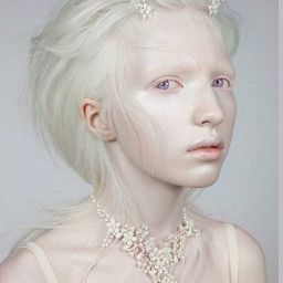 albino model woman girl portrait